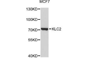 Image no. 1 for anti-Kinesin Light Chain 2 (KLC2) antibody (ABIN1873429)