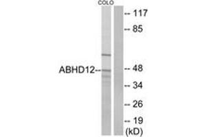 Image no. 1 for anti-Abhydrolase Domain Containing 12 (ABHD12) (AA 231-280) antibody (ABIN1534580)