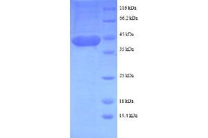Image no. 1 for LIM Domain Only 1 (Rhombotin 1) (LMO1) (AA 5-156), (partial) protein (GST tag) (ABIN1047610)