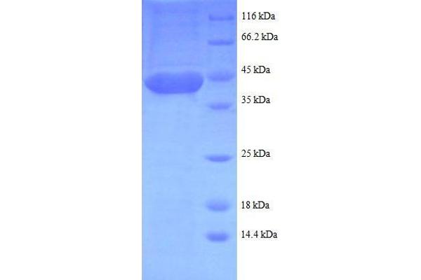 LIM Domain Only 1 (Rhombotin 1) (LMO1) (AA 5-156), (partial) protein (GST tag)