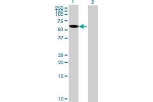 Image no. 1 for anti-RAB Guanine Nucleotide Exchange Factor (GEF) 1 (RABGEF1) (AA 1-491) antibody (ABIN525976)