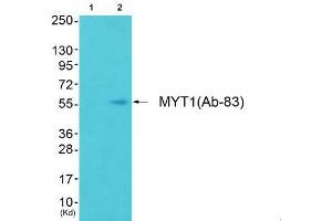 Image no. 2 for anti-Myelin Transcription Factor 1 (MYT1) (Ser83) antibody (ABIN1848242)