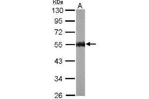 Image no. 1 for anti-Protein Kinase, AMP-Activated, gamma 2 Non-Catalytic Subunit (PRKAG2) (C-Term) antibody (ABIN2856952)