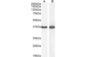 Image no. 19 for anti-Glyceraldehyde-3-Phosphate Dehydrogenase (GAPDH) (C-Term) antibody (ABIN185240)