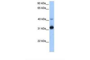 Image no. 1 for anti-Trans-2,3-Enoyl-CoA Reductase (TECR) (AA 110-159) antibody (ABIN6738459)