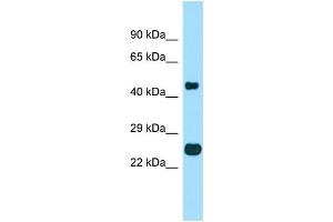 Image no. 1 for anti-Transmembrane BAX Inhibitor Motif Containing 4 (TMBIM4) (Middle Region) antibody (ABIN2790594)
