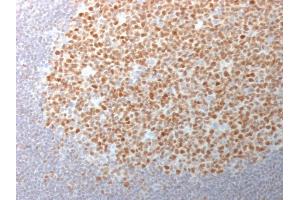 Image no. 3 for anti-B-Cell CLL/lymphoma 6 (BCL6) (AA 256-389) antibody (ABIN6940523)