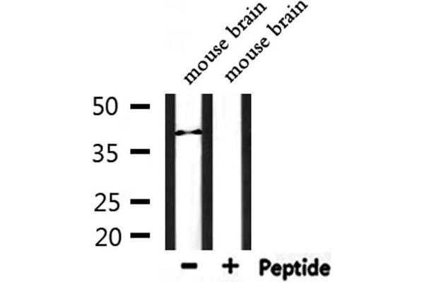 anti-Lysophosphatidic Acid Receptor 6 (LPAR6) (Internal Region) antibody