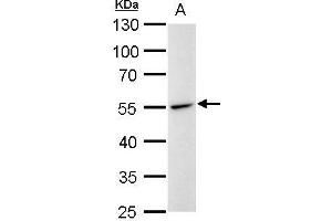 Image no. 3 for anti-Desmin (DES) (Center) antibody (ABIN2855655)