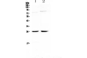 Image no. 1 for anti-Neuromedin U (NMU) antibody (ABIN5692905)