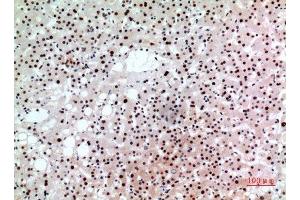 Image no. 3 for anti-B-Cell CLL/lymphoma 6 (BCL6) (Internal Region) antibody (ABIN3187827)