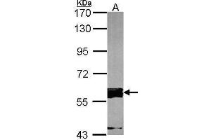 Image no. 2 for anti-Fas-Activated serine/threonine Kinase (FASTK) (C-Term) antibody (ABIN2855426)