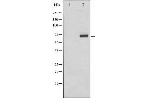 anti-Ribosomal Protein S6 Kinase, 70kDa, Polypeptide 1 (RPS6KB1) (pThr229) antibody