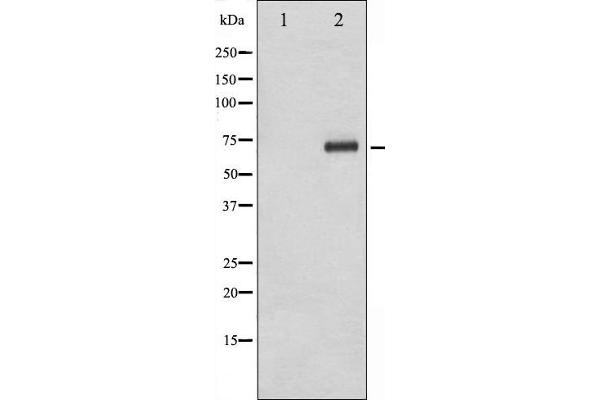 anti-Ribosomal Protein S6 Kinase, 70kDa, Polypeptide 1 (RPS6KB1) (pThr229) antibody