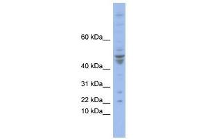 Image no. 1 for anti-Polymerase (DNA-Directed), epsilon 4 (p12 Subunit) (POLE4) (N-Term) antibody (ABIN927800)