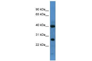 Image no. 1 for anti-Forkhead Box L2 (FOXL2) (C-Term) antibody (ABIN2781197)