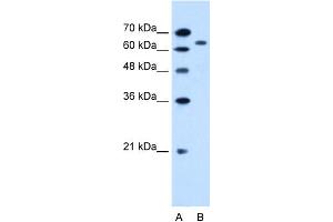 Image no. 1 for anti-Organic Cation Transporter 3 (OCT3) (N-Term) antibody (ABIN2781678)