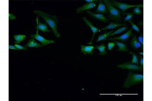 Image no. 2 for anti-Small Nuclear Ribonucleoprotein Polypeptides B and B1 (SNRPB) (AA 1-240) antibody (ABIN520350)
