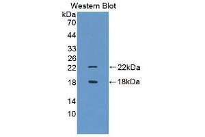 Image no. 1 for anti-Arginine Vasopressin Induced Protein 1 (AVPI1) antibody (ABIN1077839)