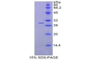 Image no. 1 for N-Acylethanolamine Acid Amidase (NAAA) (AA 112-359) protein (His tag) (ABIN1877457)