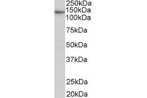 Image no. 2 for anti-Telomerase Reverse Transcriptase (TERT) (AA 597-611) antibody (ABIN940568)