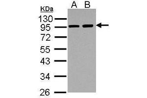 anti-Actinin, alpha 3 (ACTN3) (Center) antibody