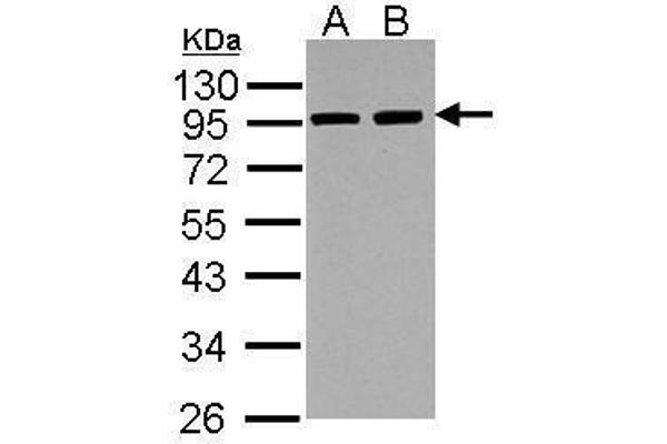 anti-Actinin, alpha 3 (ACTN3) (Center) antibody
