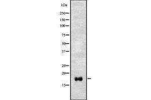 Image no. 1 for anti-Eosinophil Cationic Protein (ECP) antibody (ABIN6261424)