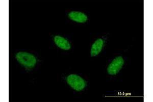 Image no. 2 for anti-Nuclear Transcription Factor Y, beta (NFYB) (AA 1-207) antibody (ABIN561994)
