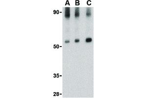 Image no. 4 for anti-Mitochondrial Antiviral Signaling Protein (MAVS) (Internal Region) antibody (ABIN6657099)