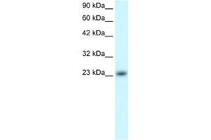 anti-MAX Dimerization Protein 4 (MXD4) (N-Term) antibody