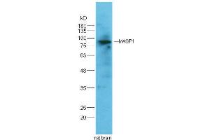 MASP1 antibody  (AA 20-120)