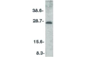 Image no. 2 for anti-Cell Death-Inducing DFFA-Like Effector A (CIDEA) (C-Term) antibody (ABIN6657449)