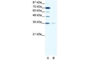 Image no. 1 for anti-Zinc Finger Protein 326 (ZNF326) (C-Term) antibody (ABIN925772)