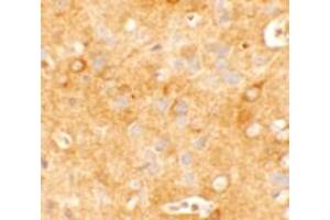 Image no. 2 for anti-Potassium Channel, Subfamily K, Member 12 (KCNK12) (C-Term) antibody (ABIN1450041)