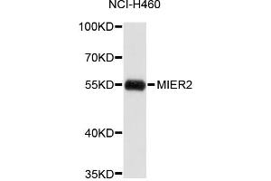 Image no. 1 for anti-Mesoderm Induction Early Response 1, Family Member 2 (MIER2) antibody (ABIN1876102)
