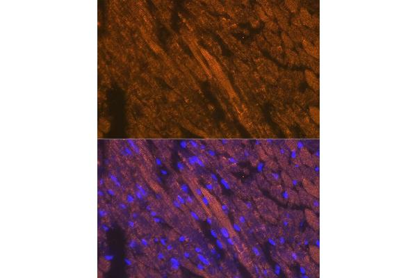 Cardiac Troponin T2 anticorps  (AA 1-120)