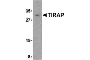 Image no. 2 for anti-Toll-Interleukin 1 Receptor (TIR) Domain Containing Adaptor Protein (TIRAP) (Center) antibody (ABIN500925)