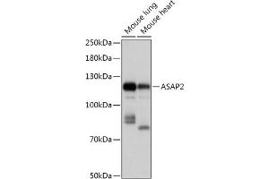 ASAP2 antibody  (AA 1-120)