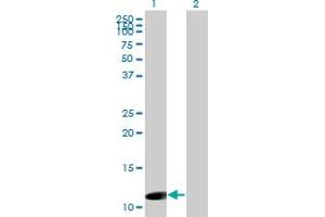 Western Blot analysis of ORF1-FL49 expression in transfected 293T cell line by ORF1-FL49 monoclonal antibody (M02), clone 4E11.