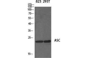 Image no. 1 for anti-Steroid Sulfatase (STS) (N-Term) antibody (ABIN3183398)