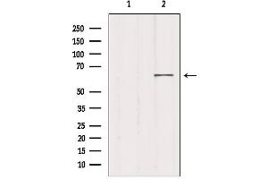 Image no. 2 for anti-Mediator Complex Subunit 26 (MED26) antibody (ABIN6257835)