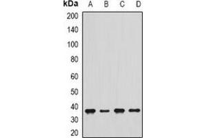 Image no. 2 for anti-Sarcoglycan, delta (35kDa Dystrophin-Associated Glycoprotein) (SGCD) antibody (ABIN3198032)