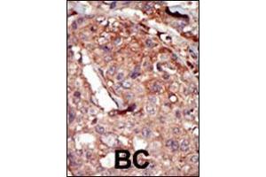 Image no. 3 for anti-Bromodomain Containing 2 (BRD2) (AA 170-200) antibody (ABIN392609)