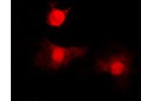Image no. 1 for anti-Histone Deacetylase 8 (HDAC8) (N-Term), (pSer39) antibody (ABIN2707553)