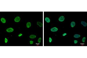 Image no. 4 for anti-RecQ Protein-Like (DNA Helicase Q1-Like) (RECQL) (C-Term) antibody (ABIN2857057)