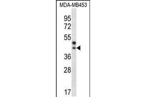 PPT2 antibody  (AA 183-212)