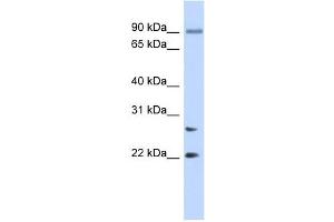anti-Josephin Domain Containing 2 (JOSD2) (N-Term) antibody