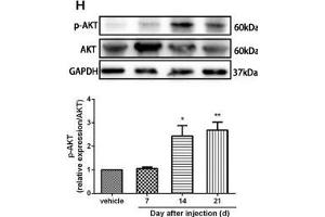 Image no. 34 for anti-Glyceraldehyde-3-Phosphate Dehydrogenase (GAPDH) antibody (ABIN3020541)