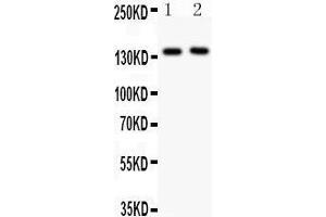 Image no. 1 for anti-Selectin P (Granule Membrane Protein 140kDa, Antigen CD62) (SELP) (AA 42-271) antibody (ABIN3043327)